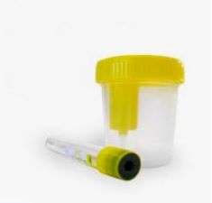 Instrucciones para la recogida de orina en Terrassa