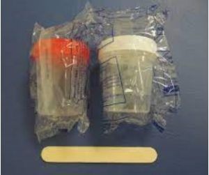 Instrucciones para la recogida de muestras de heces