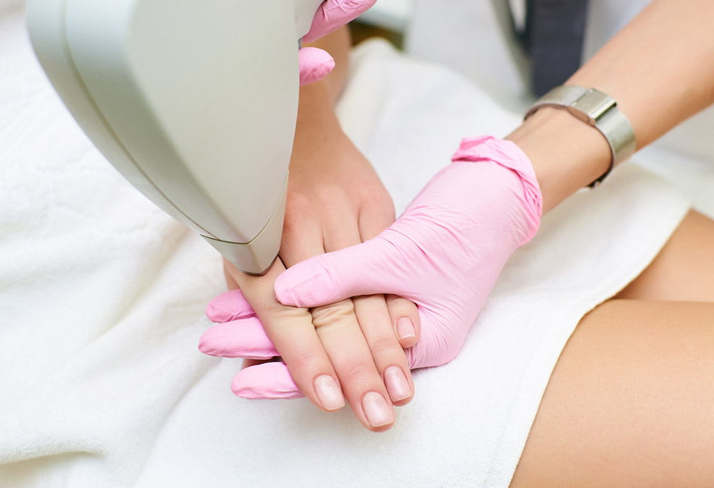 Fotorejuvenecimiento corporal con IPL en Terrassa